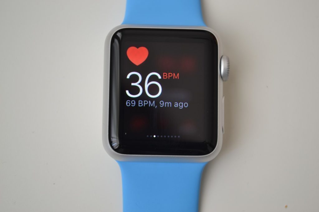 Apple Watch glances 1