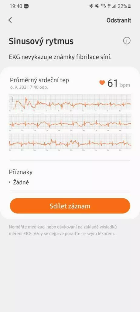 Samsung Health Monitor 8 EKG graf