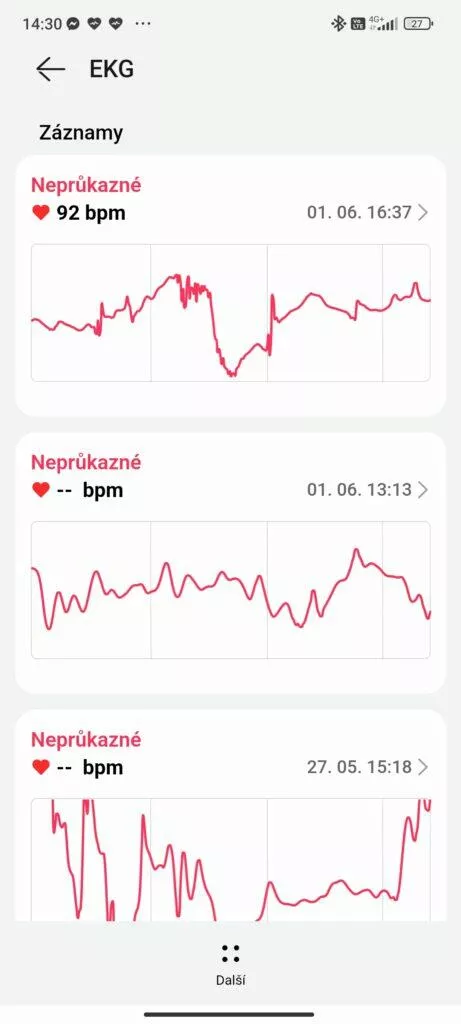 EKG Huawei Watch GT 3 Pro