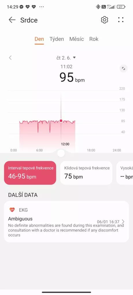 tepová frekvence huawei watch gt 3 pro