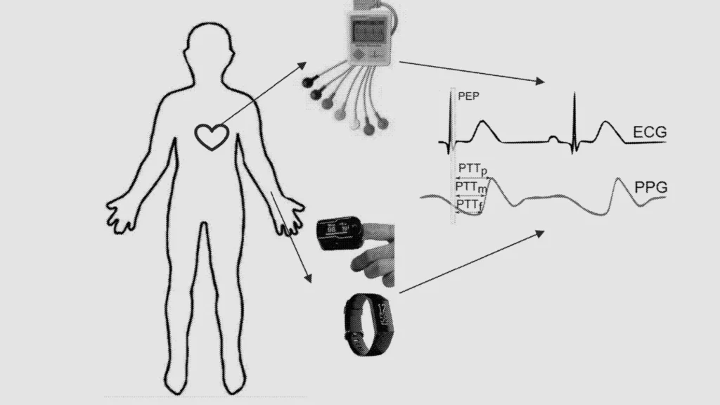 ekg senzor tepu