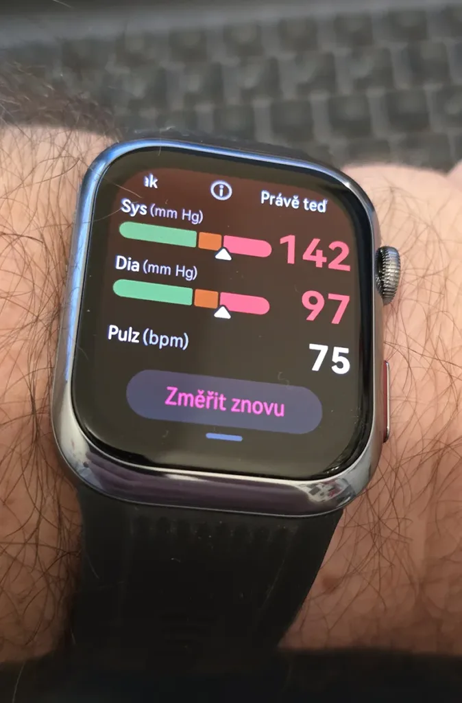 huawei watch d2 na ruce